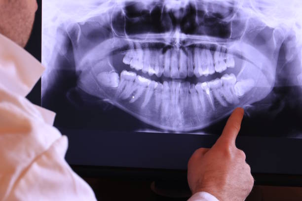 Best Dentist for Tooth Abscess  in Ringwood, NJ